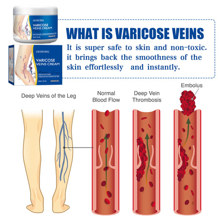 Leg Repair Cream Gently Massages Legs Soothing Body Care Leg Relief Topical Lotion - V.I.P Digital Presence