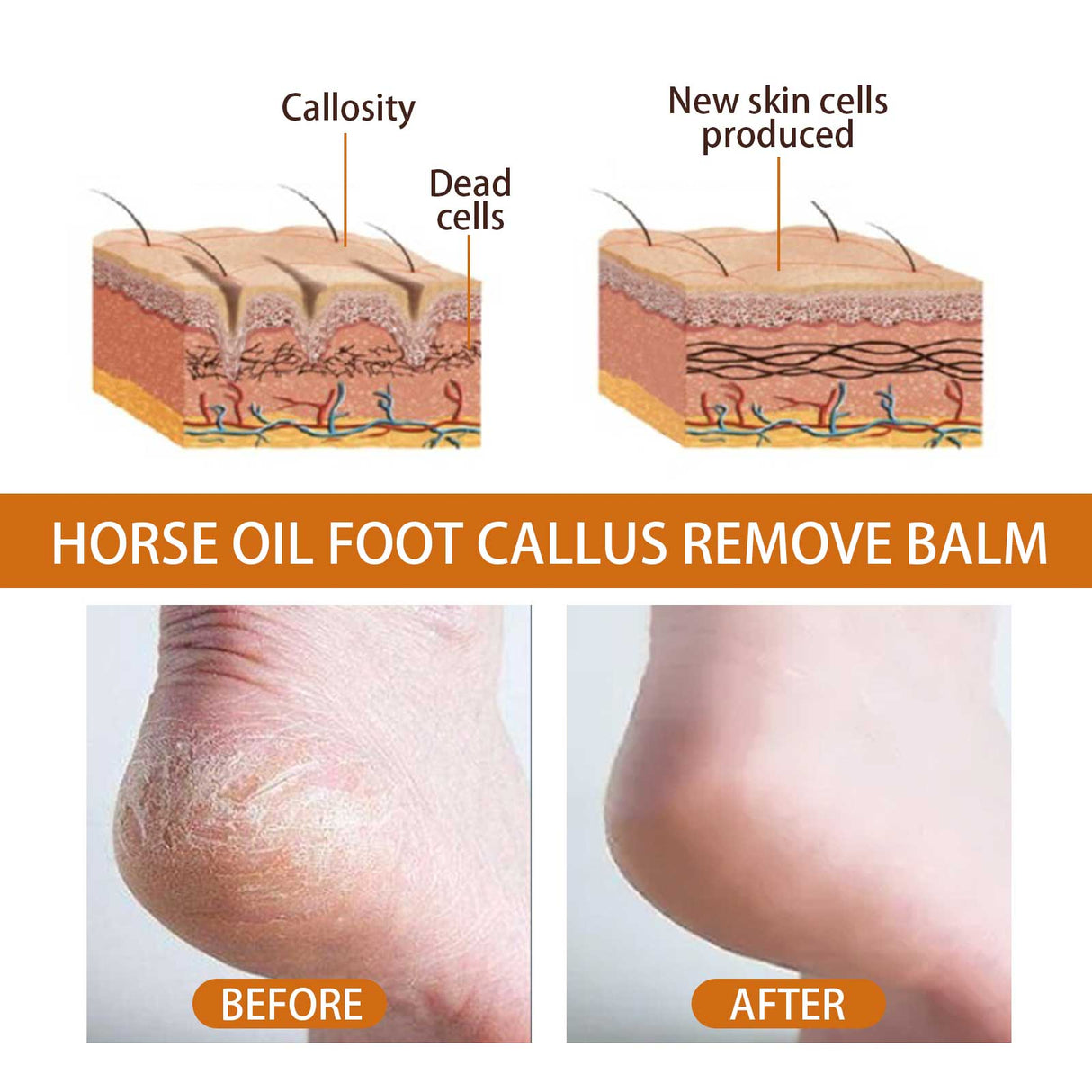 Foot Spray, Exfoliates Prevents Dry Cracking And Repairs Rough Skin Moisturizing Treatment Spray - V.I.P Digital Presence
