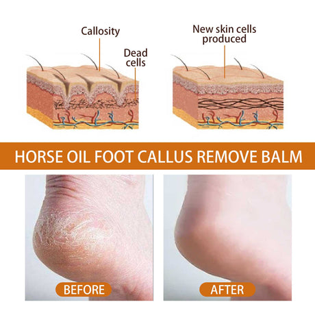 Foot Spray, Exfoliates Prevents Dry Cracking And Repairs Rough Skin Moisturizing Treatment Spray - V.I.P Digital Presence