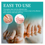 Nail Repair Pen, Repair Hands And Feet Gray Nails Brightening Nails Soft Nails Thickening Nails Moisturizing Care - V.I.P Digital Presence
