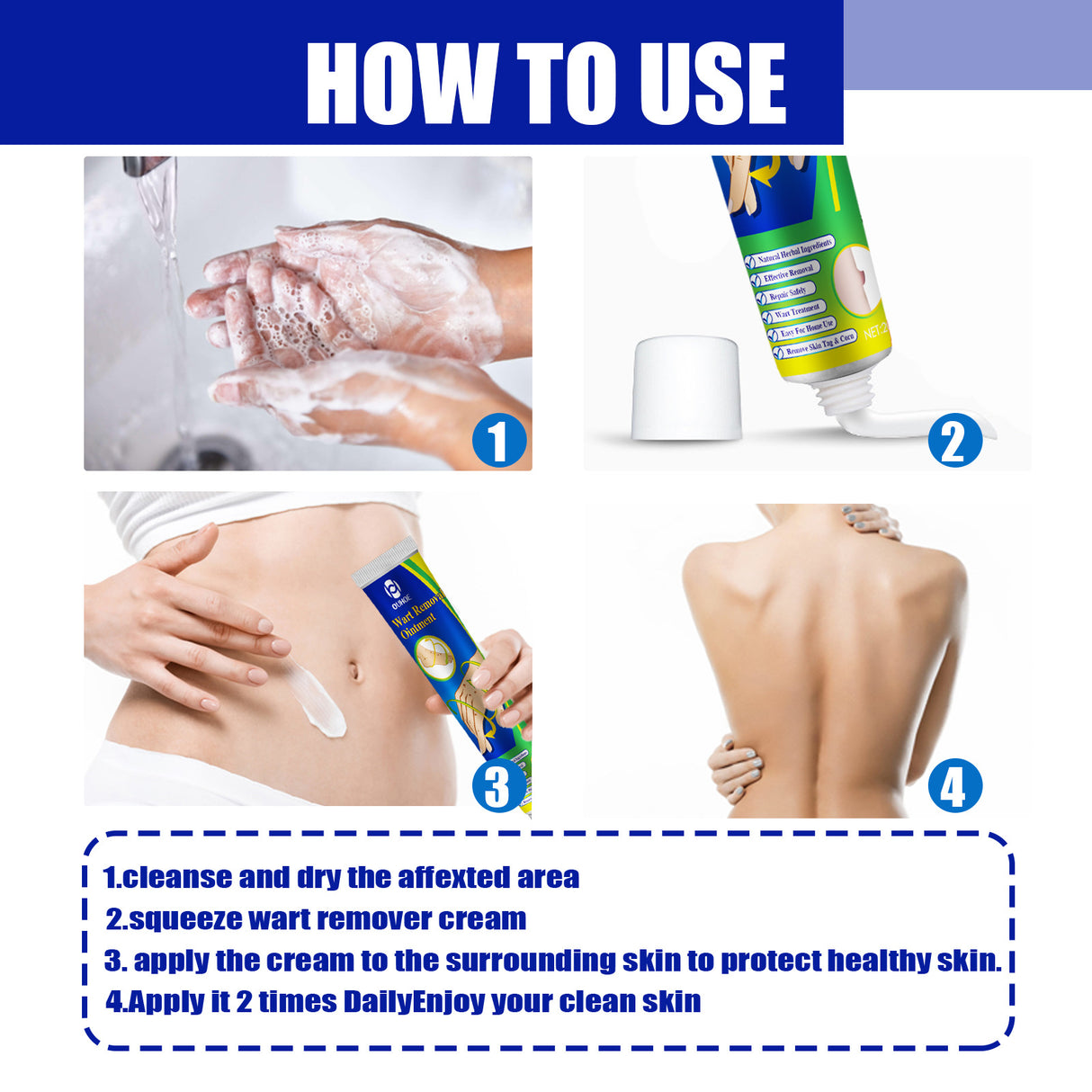 Wart Remover Ointment, Remove Hou Warts Flat Corn Plaster Flat Grains Warts, Foot And Repair Skin Dot Mole G Wart Cream - V.I.P Digital Presence