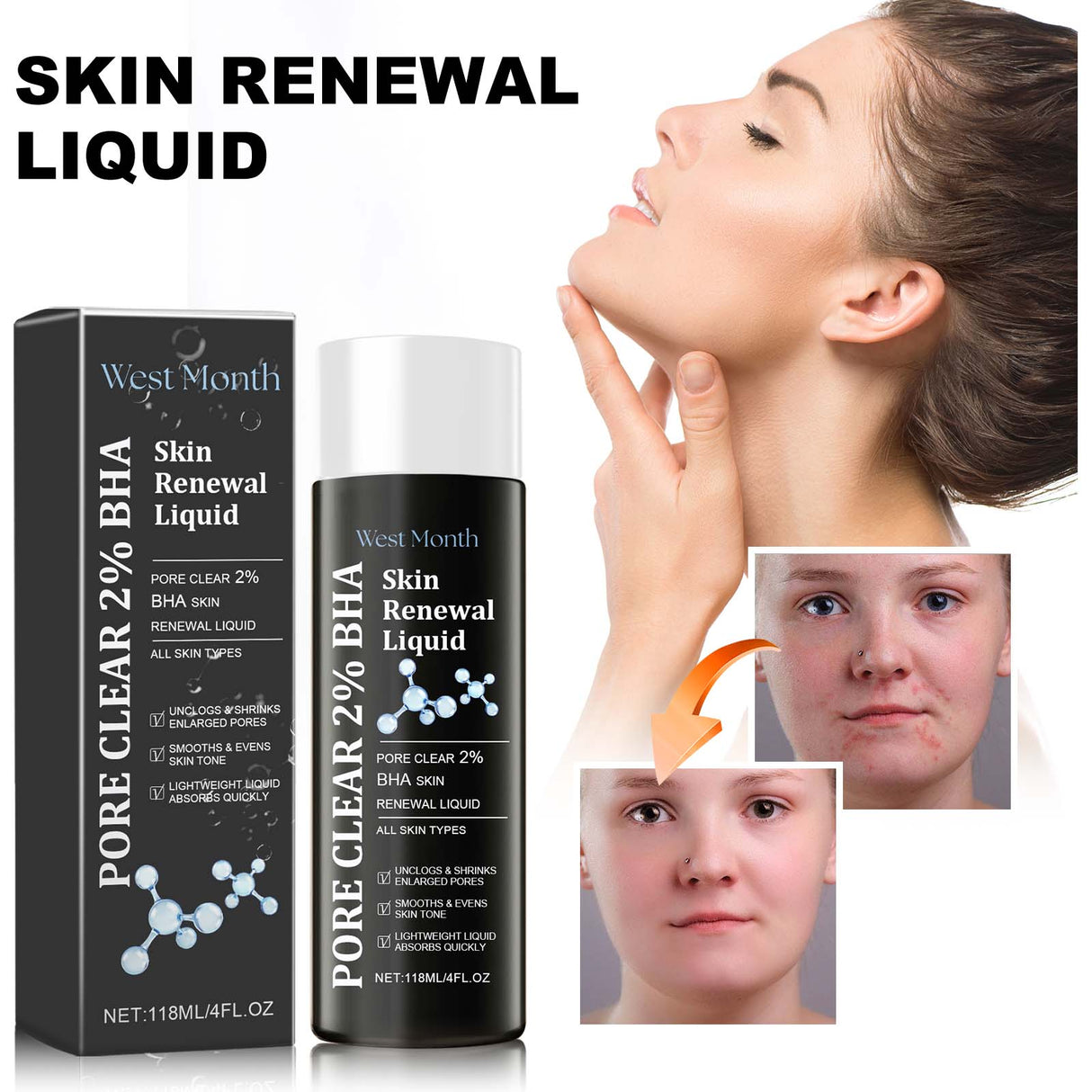 Skin Renewal Liquid, Reduce Acne Print Repair Acne Muscle Mild Clear Acne Hydrating Essence - V.I.P Digital Presence