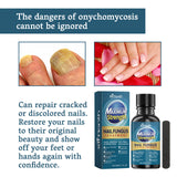 Nail Fungus Treatment, Nail Thickening Of Embedded Light Mail This Soft Armour Brothers Nails Detailer - V.I.P Digital Presence