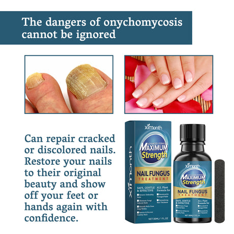 Nail Fungus Treatment, Nail Thickening Of Embedded Light Mail This Soft Armour Brothers Nails Detailer - V.I.P Digital Presence