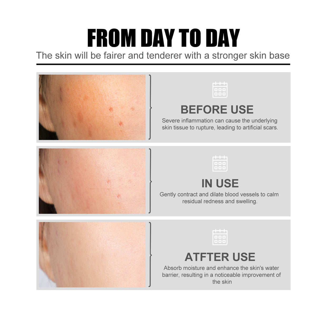 Nicotinic Acid Face Essence Lighten Acne Marks, Moisturize Pores, Shrink And Whiten Skin Beauty Essence - V.I.P Digital Presence