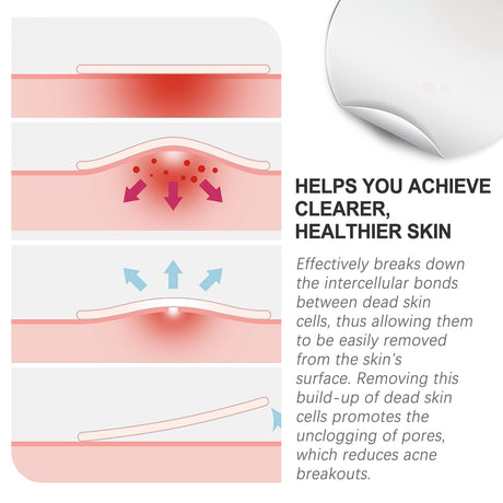 Acne Patch, Repair Acne Pimples Acne Invisible Concealer Breathable Acne Patch - V.I.P Digital Presence
