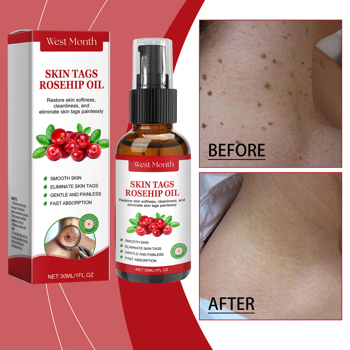 Rosehip Seed And Wart Essence Oil, Moisturizes And Restores Smooth Skin - V.I.P Digital Presence