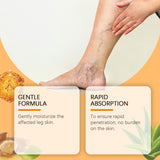 Bee Venom Leg Treatment Spray, Daily Relief Of Leg Curvature Discomfort Leg Treatment Spray - V.I.P Digital Presence