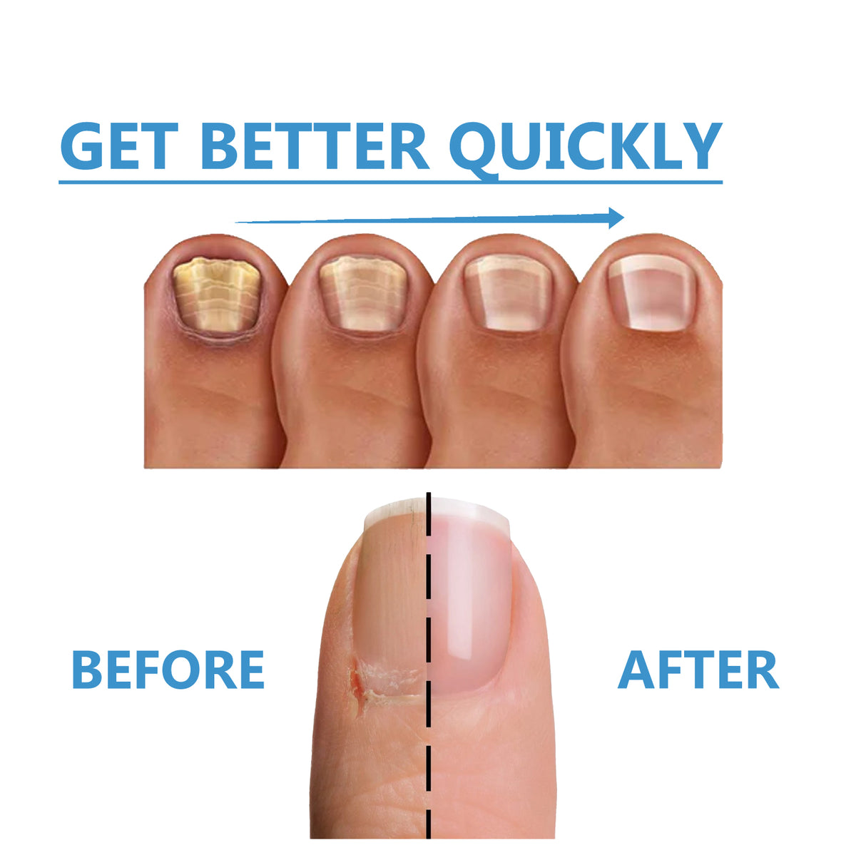 Nighttime Fungal Nail Treatment Patch, Repair Hand And Foot Inlay Rotten Nails Thickening Gray Nail Polish Care Patch - V.I.P Digital Presence