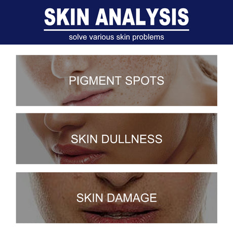 Skin Genesis Spot Whitening Cream, Filling Water To Moisten Soft Delicate Chun White Brighten The Melanin Of Skin Cream - V.I.P Digital Presence