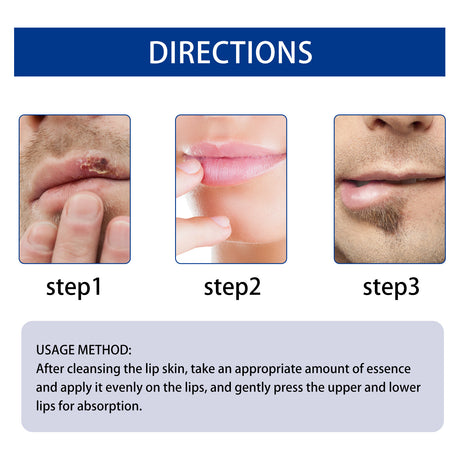 EAST MOON Lip Essence Rolling Lotion, Moisturize And Fade Lip Lines, Prevent Dry Crack And Dead Skin, Plump And Moisturize Lips - V.I.P Digital Presence