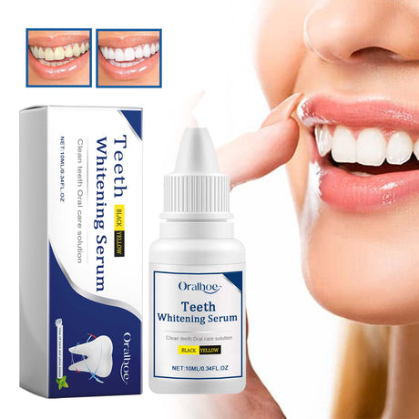 Teeth Whitening Serum, Remove Stains Yellow Dirt Deep Cleaning Whitening Essence - V.I.P Digital Presence
