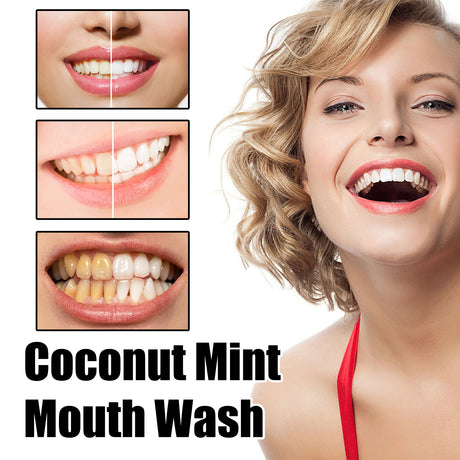 Teeth Rinse, Deep Clean Mouth Fresh, Deodorizing And Whitening Teeth Stain Removing Mouthwash - V.I.P Digital Presence