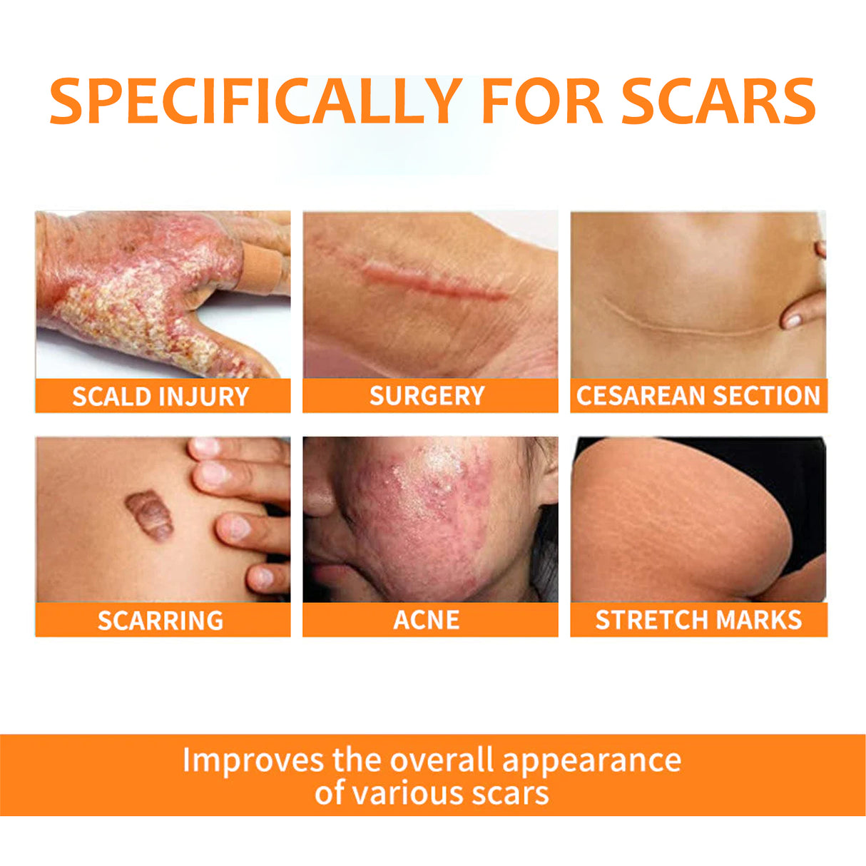 Skin Repair Pen For Reducing Pregnancy Burns Scars And Smoothing The Skin - V.I.P Digital Presence