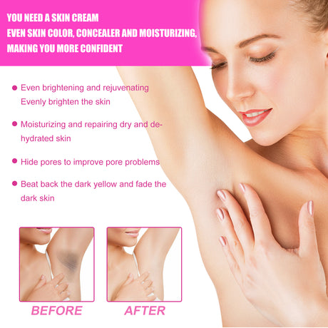 Whitening Cream, Whitening And Brightens Skin, Moisturizes And Removes Blackness Beauty Skin Cream - V.I.P Digital Presence