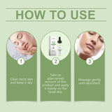 Azelaic Acid Facial Essence Moisturizes And Improves The Skin For Blackheads And Acne