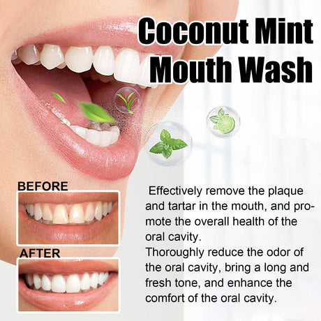 Teeth Rinse, Deep Clean Mouth Fresh, Deodorizing And Whitening Teeth Stain Removing Mouthwash - V.I.P Digital Presence