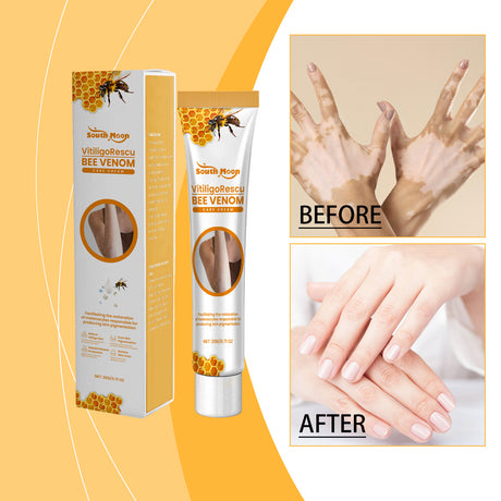 Skin Repair Cream, Moisturizing And Nourishing Moisturizing Skin With Massage Skin Care Body Care Cream - V.I.P Digital Presence