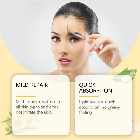 Acne-Clearing Gel, Deep Cleansing Facial Skin Brightening And Concealer Treatment Gel For Acne Reduction - V.I.P Digital Presence