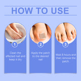 Nail Care Patches Gently Repair Nails For Easy Daily Cleaning With Simple Care Patches - V.I.P Digital Presence