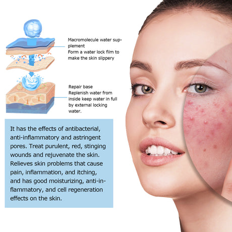 Hyaluronic Acid Face Serum, Moisturizing Repair Lighten Acne Mark Skin Care Whitening Essence - V.I.P Digital Presence