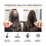 Dense Hair Essential Oil, Moisturize And Thicken Hair Repair Hair Root Damaged Hair Strong Firming Hair Care Essential Oil - V.I.P Digital Presence