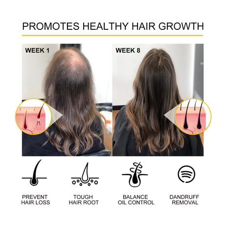 Dense Hair Essential Oil, Moisturize And Thicken Hair Repair Hair Root Damaged Hair Strong Firming Hair Care Essential Oil - V.I.P Digital Presence