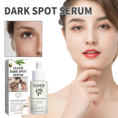 Dark Spot Serum, Fade Spot Moisturize Skin Repair Blain Mark Face Dull Shine Essence - V.I.P Digital Presence