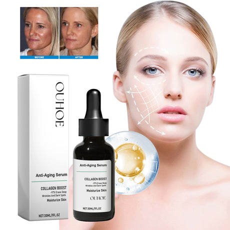 Ouhoe Collagen Anti-Wrinkle Facial Essence Reduces Fine Lines, Moisturizes, Tightens, And Moisturizes Skin - V.I.P Digital Presence