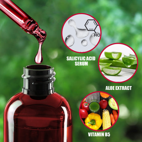 AHA30% + BHA 2% Fruit Acid Salicylic Acid Essence, Exfoliating Cleaning Blackheads Acne And Shrinking Pores Essence - V.I.P Digital Presence
