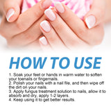 Toenail Fungus Treatment, Repair The Brotherhood Of Nails Rotten Jiasheng Mail This Soft Armour A Detailer - V.I.P Digital Presence