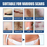 Scar Balm, Surgery Scar Repair Cold Compress Scar Skin Scar Gel Balm - V.I.P Digital Presence