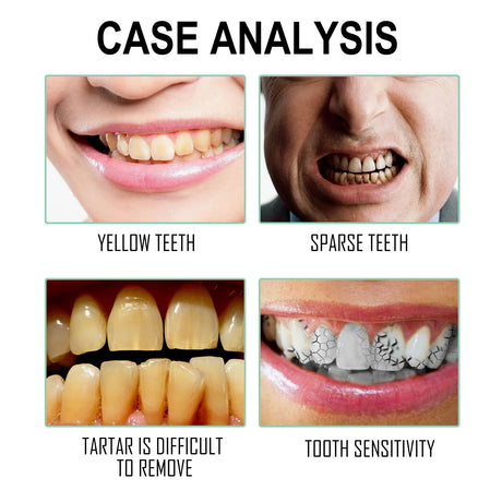 Dental Floss Picks, Dental Cleaning Interdental Flossing Disposable Household Portable Floss Stick - V.I.P Digital Presence