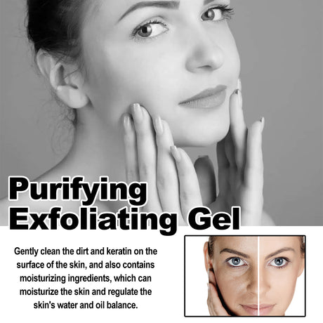 Purifying Exfoliating Gel, Chun White Tender Skin Clean Bright Skin Cutin Tighten Pores - V.I.P Digital Presence