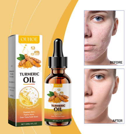 Ouhoe Cleansing Turmeric Oil Gently Cleanses And Moisturizes Facial Skin, Brightening And Whitening Skin With A Refreshing Cleansing Oil - V.I.P Digital Presence