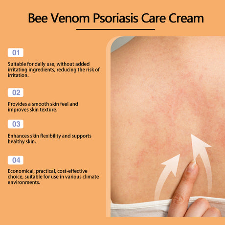 Bee-Venom Cowhide Moss Care Cream Moisturizes And Restores Itchy Red And Swollen Hands And Feet Skin Care Cream - V.I.P Digital Presence