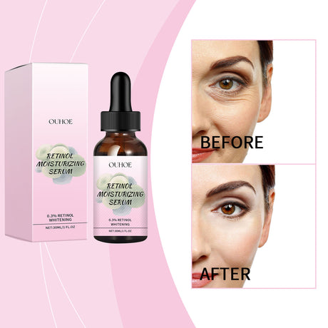 Retinol Hydrating Serum, A Delicate And Moisturizing Face Anti-Wrinkle Serum With Retinol Vitamin C - V.I.P Digital Presence