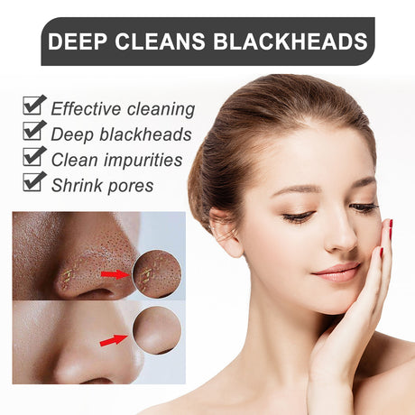 Blackhead Peel Mask, Deep Cleansing Facial Skin Removes Blackheads, Pimples, Shrinks Pores And Tenderizes Skin - V.I.P Digital Presence