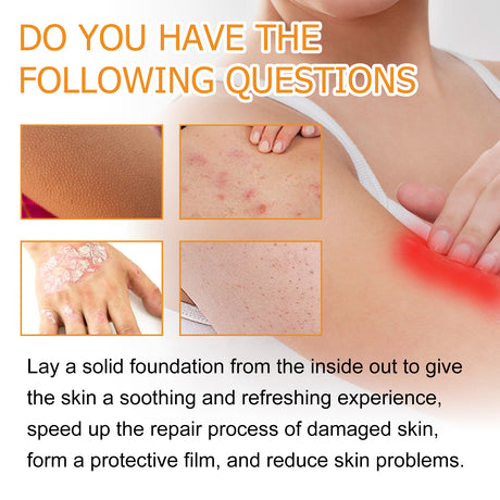 Bee Venom Psoriasis Care Spray, Soothing Skin Irritation Repair Moisturizing And Tender Skin Care Spray - V.I.P Digital Presence