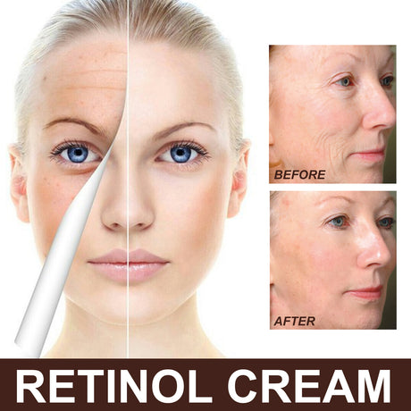 Retinol Cream, Anti-Aging Firming Brightening Moisturizing Facial Skin Care Cream - V.I.P Digital Presence