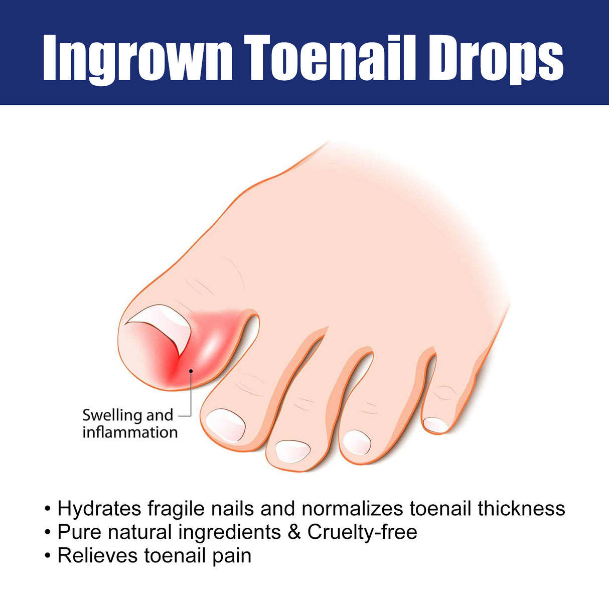 Nail Repair Solution Gentle Clean, Moisturize, Moisturize And Nourish Nails And Nails