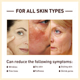 Rice Anti Wrinkle Essence, Repairs Skin Moisturizes Firms Whitens Essence - V.I.P Digital Presence