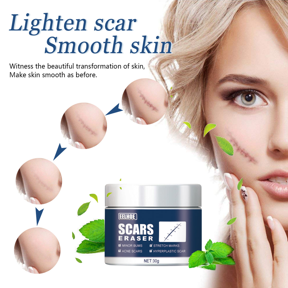Scar Balm, Surgery Scar Repair Cold Compress Scar Skin Scar Gel Balm - V.I.P Digital Presence