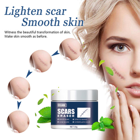 Scar Balm, Surgery Scar Repair Cold Compress Scar Skin Scar Gel Balm - V.I.P Digital Presence