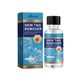 Keyu Liquid Hand And Foot Skin Especially Moles Cleansing Repair Smooth Skin Skin Label Care Liquid - V.I.P Digital Presence