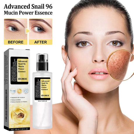 Snail 96 Collagen Power Essence, Repair Skin Barrier Moisturizing And Fading Dark Spots Snail Essence - V.I.P Digital Presence