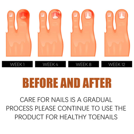 Anti-Nail Groove Relief Oil, Repair Inlaid Nails Gray Nails And Soft Thickening Nail Brightening Nails Care Oil - V.I.P Digital Presence