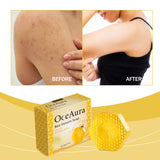 Oceaura Bee Venom Soap For Deep Body Cleansing, Moisturizing, Brightening And Improving Skin And Bathing Body Soap - V.I.P Digital Presence