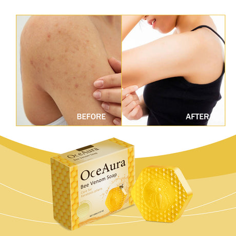 Oceaura Bee Venom Soap For Deep Body Cleansing, Moisturizing, Brightening And Improving Skin And Bathing Body Soap - V.I.P Digital Presence