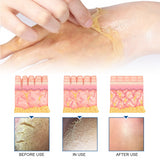 Exfoliating Hand Mask Moisturizes And Moisturizes Tender Skin, Alleviates Dry, Rough And Chapped Hands